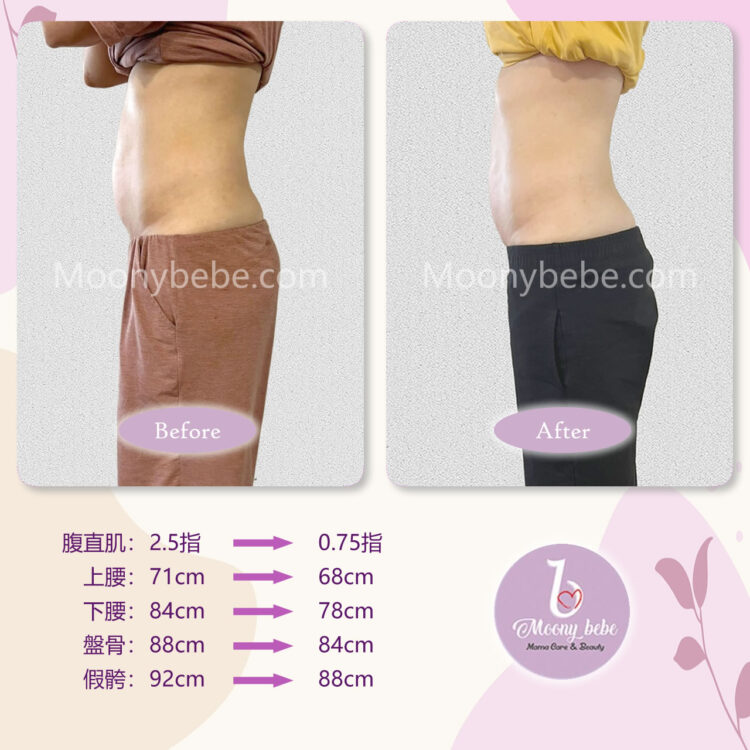 Before After 左侧面