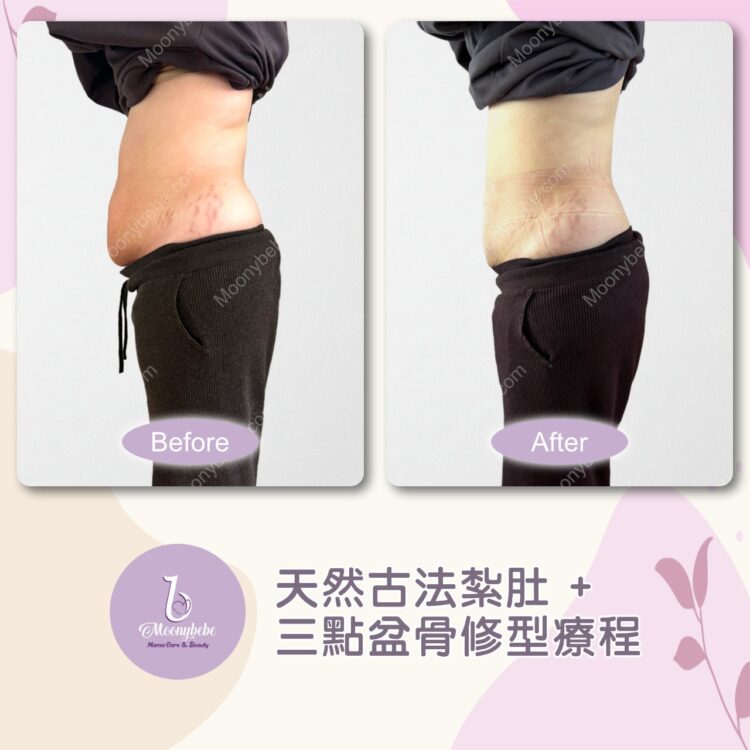 Before & After - Left