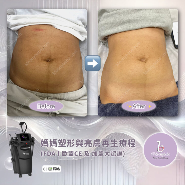 Before & After