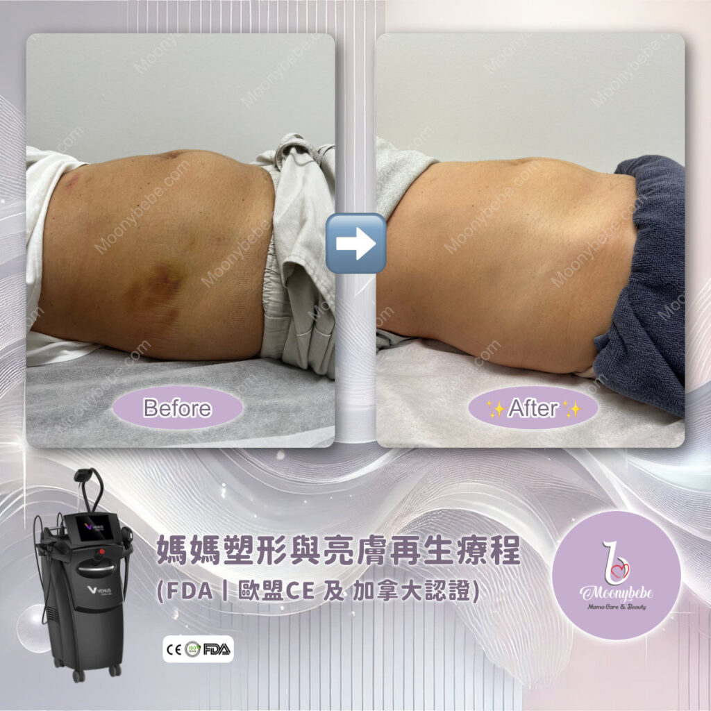 Before & After Treatment