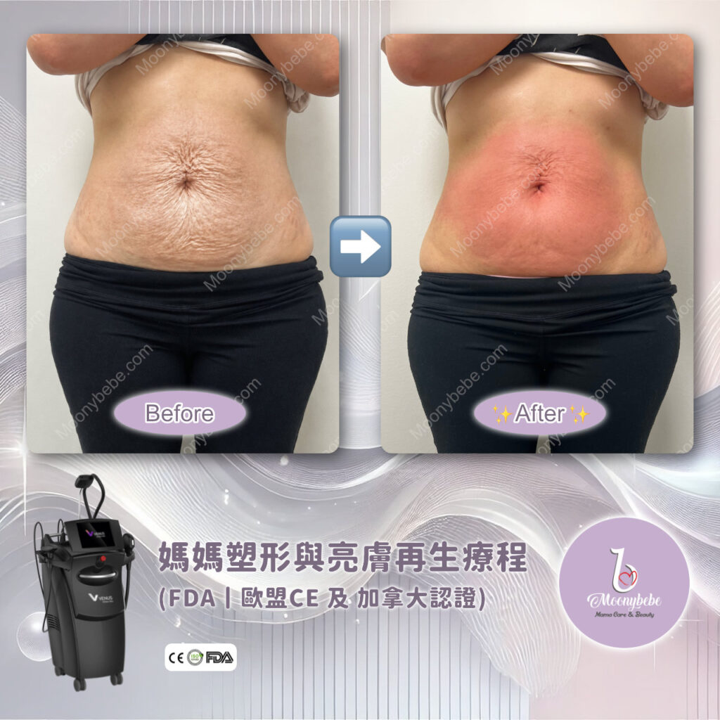 Before & After Treatment