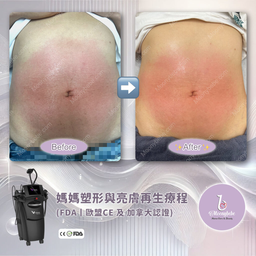 Before & After Treatment