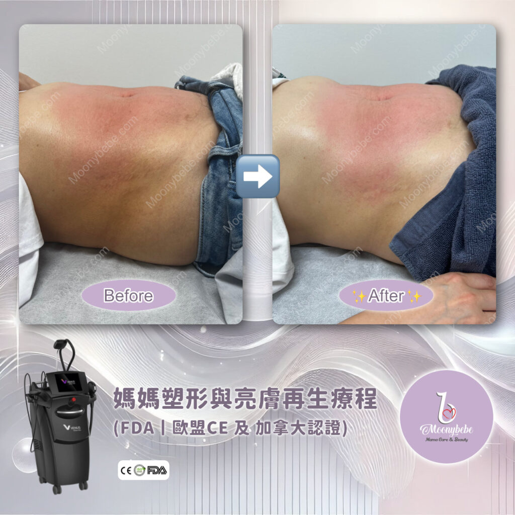 Before & After Treatment